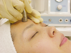 ダイヤモンドピール