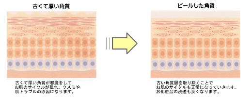 クリスタルピール